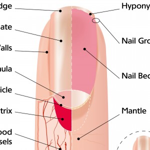 Ingrown Toenails