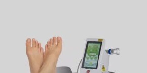 Laser fungal nail treatment